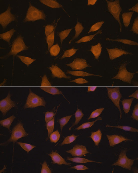 Cyclin A2 Rabbit Polyclonal Antibody