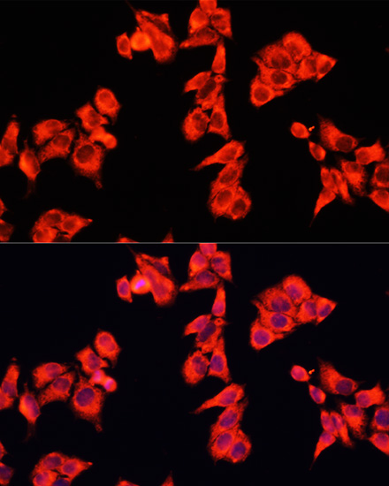ARHGAP5 Rabbit Polyclonal Antibody