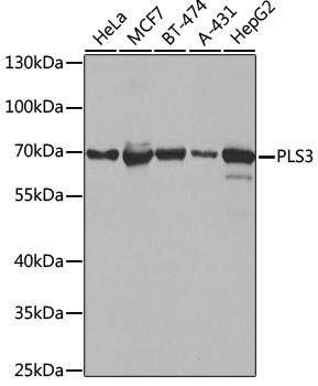 PLS3 Rabbit Polyclonal Antibody