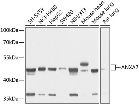 ANXA7 Rabbit Polyclonal Antibody