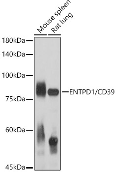 ENTPD1/CD39 Rabbit Polyclonal Antibody
