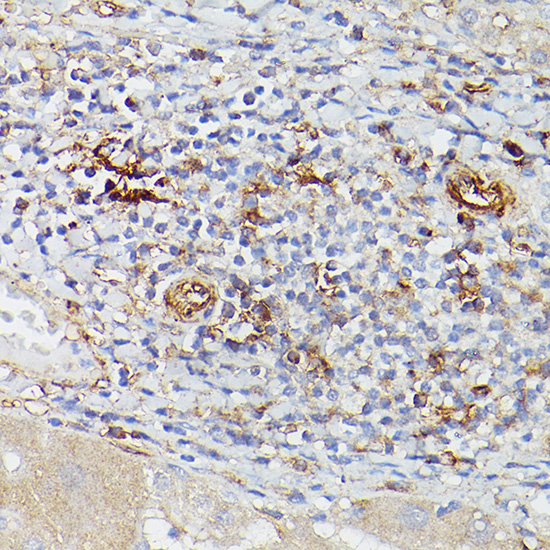 ENTPD1/CD39 Rabbit Polyclonal Antibody