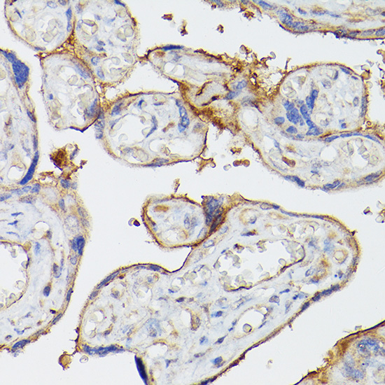 ENTPD1/CD39 Rabbit Polyclonal Antibody