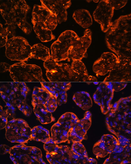 ENTPD1/CD39 Rabbit Polyclonal Antibody