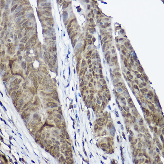 CSTB Rabbit Polyclonal Antibody