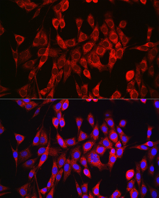 GLS Rabbit Polyclonal Antibody
