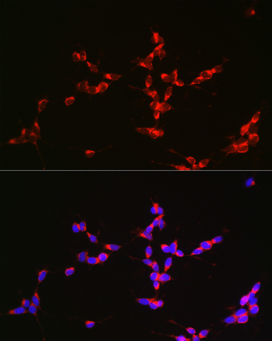 GLS Rabbit Polyclonal Antibody