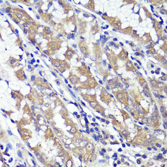 UBL3 Rabbit Polyclonal Antibody