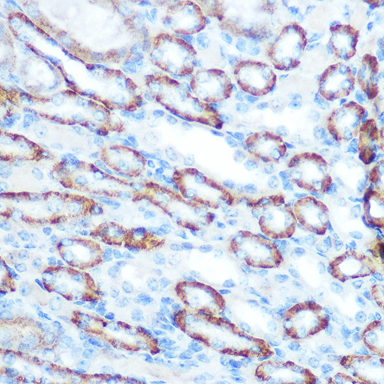 LONP1 Rabbit Polyclonal Antibody