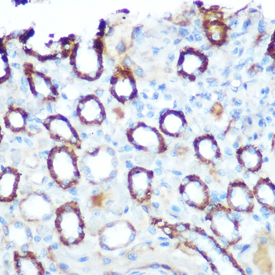 LONP1 Rabbit Polyclonal Antibody