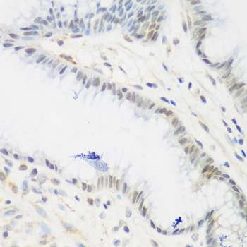 IGF2BP3 Rabbit Polyclonal Antibody
