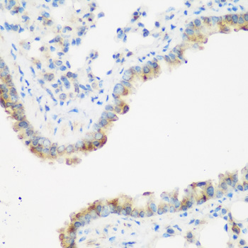 IGF2BP3 Rabbit Polyclonal Antibody