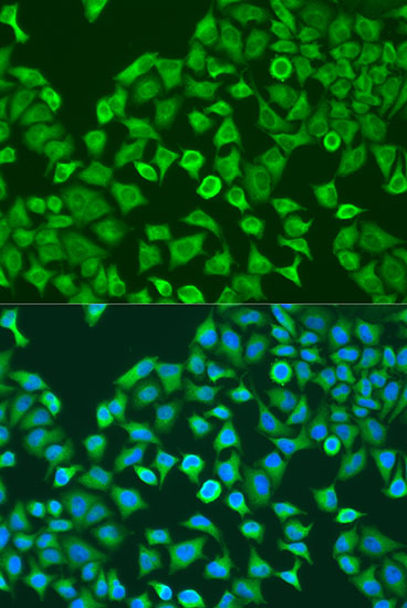 PUM1 Rabbit Polyclonal Antibody
