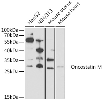 OSM Rabbit Polyclonal Antibody