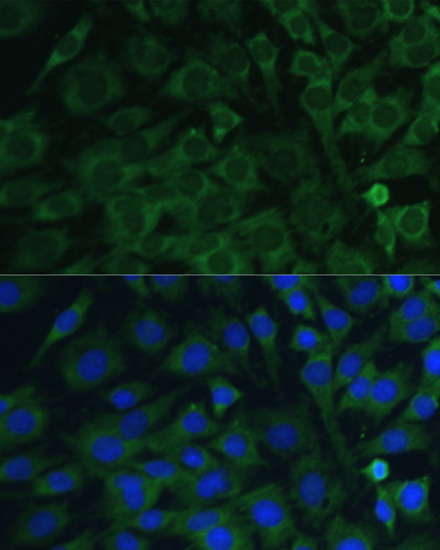 OSM Rabbit Polyclonal Antibody