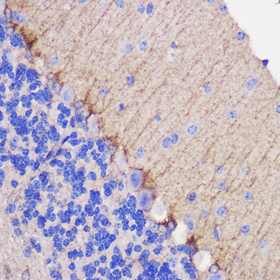 DLG4 Rabbit Polyclonal Antibody