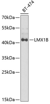 LMX1B Rabbit Polyclonal Antibody