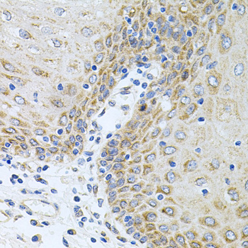 CPM Rabbit Polyclonal Antibody