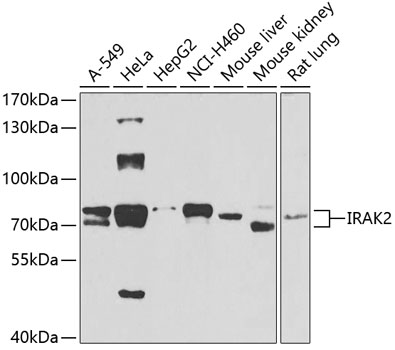 IRAK2 Rabbit Polyclonal Antibody