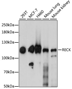 RECK Rabbit Polyclonal Antibody