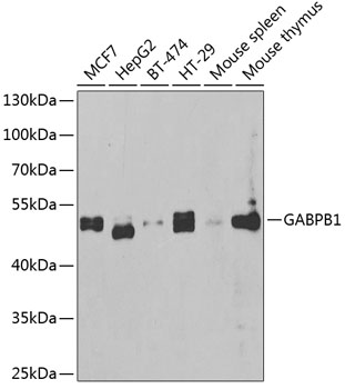 GABPB1 Rabbit Polyclonal Antibody