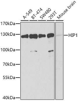 HIP1 Rabbit Polyclonal Antibody
