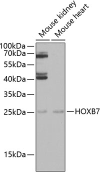 HOXB7 Rabbit Polyclonal Antibody