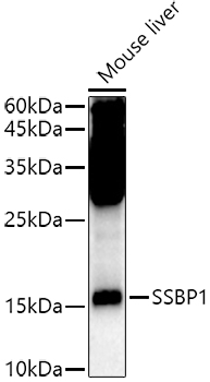 SSBP1 Rabbit Polyclonal Antibody