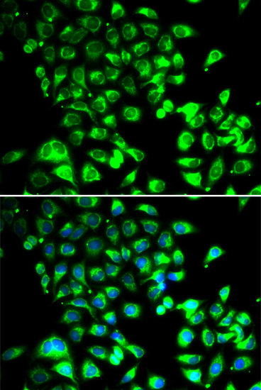 SSBP1 Rabbit Polyclonal Antibody
