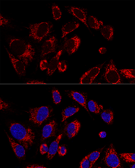 SSBP1 Rabbit Polyclonal Antibody