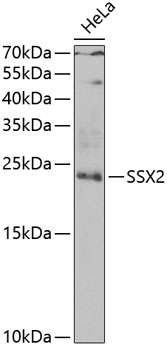 SSX2 Rabbit Polyclonal Antibody