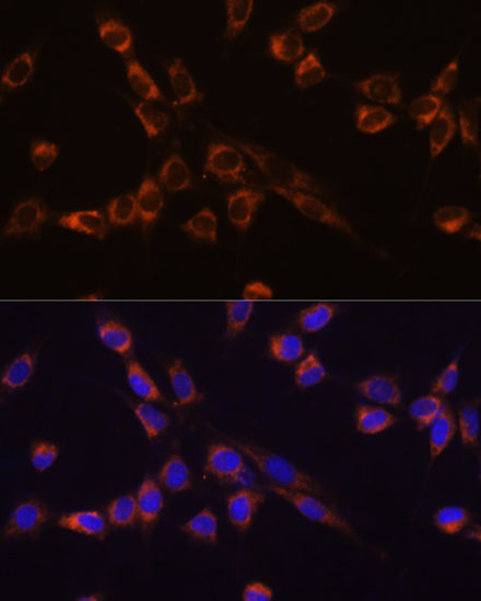 STK3 Rabbit Polyclonal Antibody
