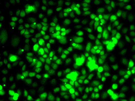 TCEB3 Rabbit Polyclonal Antibody