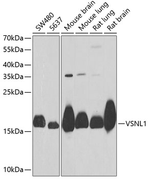 VSNL1 Rabbit Polyclonal Antibody