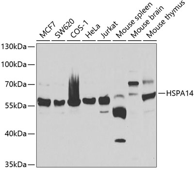 HSPA14 Rabbit Polyclonal Antibody