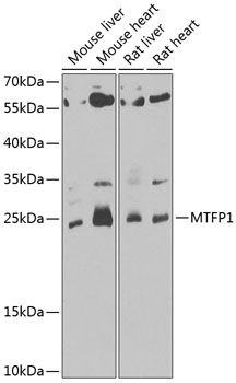 MTFP1 Rabbit Polyclonal Antibody