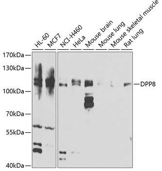 DPP8 Rabbit Polyclonal Antibody
