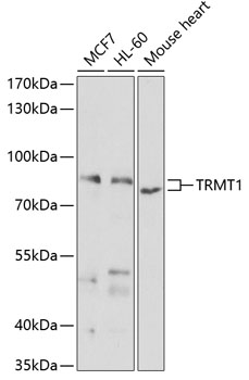 TRMT1 Rabbit Polyclonal Antibody