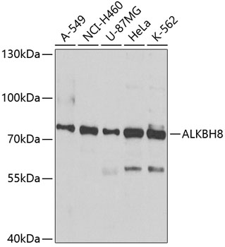 ALKBH8 Rabbit Polyclonal Antibody