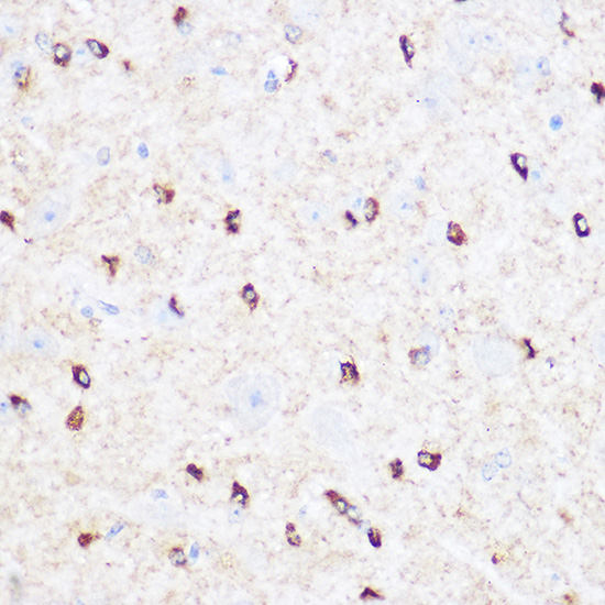 CD47 Rabbit Polyclonal Antibody