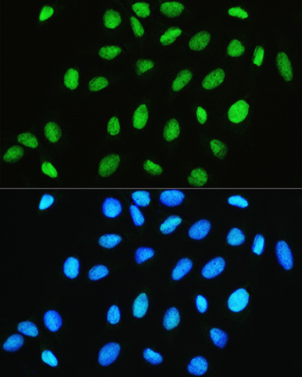 CHRAC1 Rabbit Polyclonal Antibody