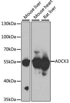 ADCK3 Rabbit Polyclonal Antibody
