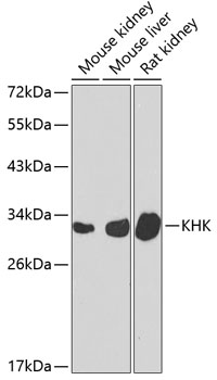 KHK Rabbit Polyclonal Antibody