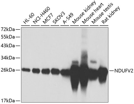 NDUFV2 Rabbit Polyclonal Antibody