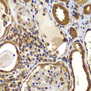 NME2 Rabbit Polyclonal Antibody
