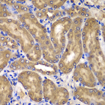 NME2 Rabbit Polyclonal Antibody