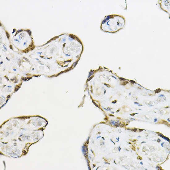 TEAD3 Rabbit Polyclonal Antibody