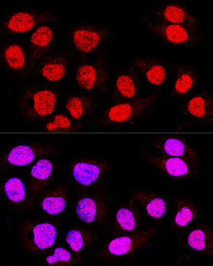 TEAD3 Rabbit Polyclonal Antibody