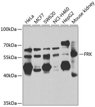 FRK Rabbit Polyclonal Antibody