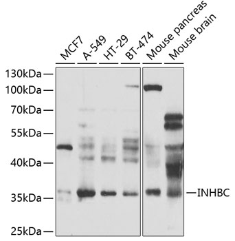 INHBC Rabbit Polyclonal Antibody